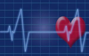 EKG of the Heart