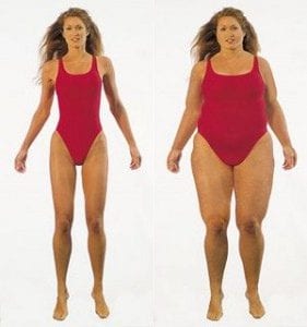 Weight Loss Before and After 