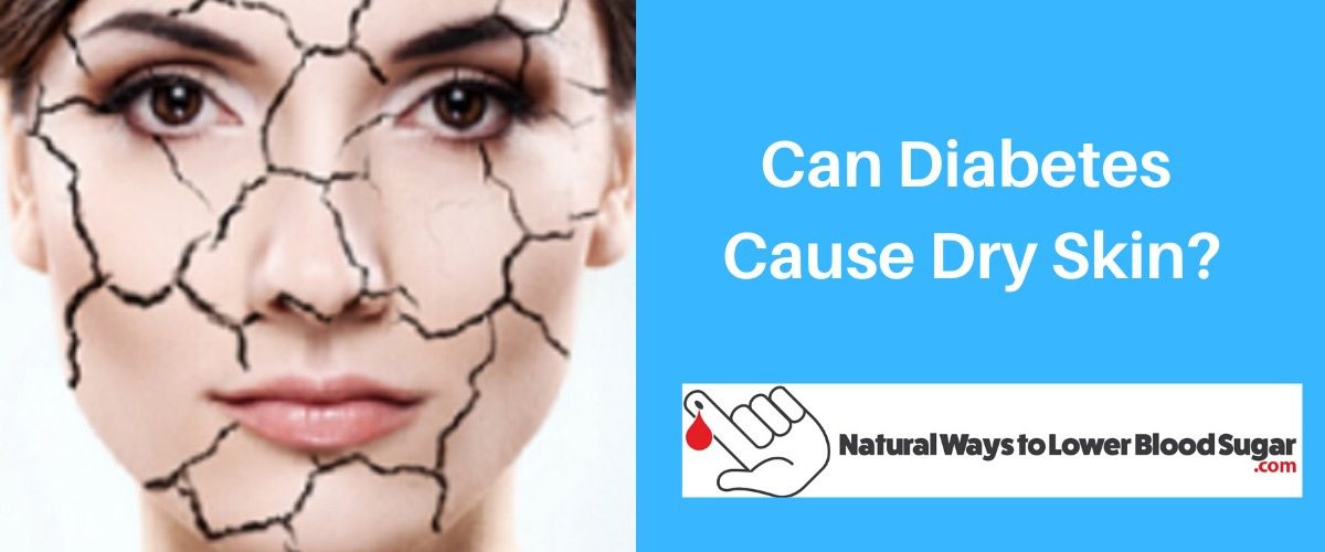 Can Diabetes Cause Dry Skin
