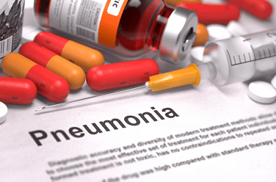 Pneumonia and Treatment