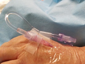 IV-Needle