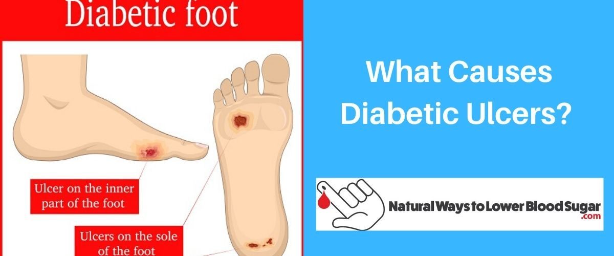 What Causes Diabetic Ulcers