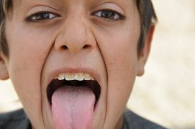 Tongue Exercise